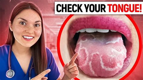 What Your Tongue Says About Your Health